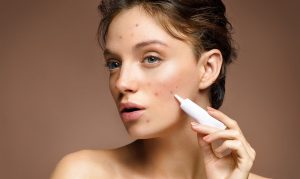 Chu trình skincare ban ngày và đêm cho da dầu mụn nhạy cảm