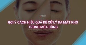 Gợi ý cách hiệu quả để xử lý da mặt khô trong mùa đông