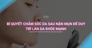 Bí quyết chăm sóc da sau nặn mụn để duy trì làn da khỏe mạnh