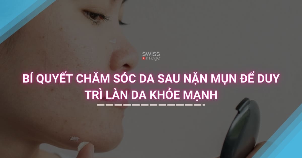 Bí quyết chăm sóc da sau nặn mụn để duy trì làn da khỏe mạnh