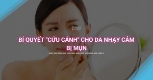 Bí quyết "cứu cánh" cho da nhạy cảm bị mụn