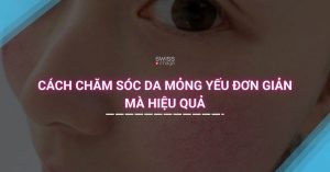 Cách Chăm Sóc Da Mỏng Yếu Đơn Giản Mà Hiệu Quả