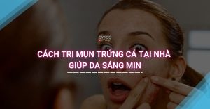 Cách trị mụn trứng cá tại nhà giúp da sáng mịn