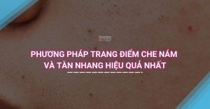 Phương pháp trang điểm che nám và tàn nhang hiệu quả nhất