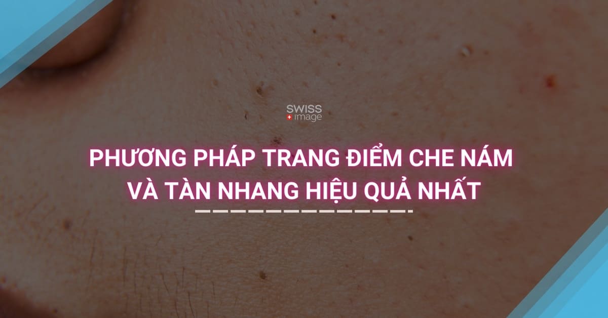 Phương pháp trang điểm che nám và tàn nhang hiệu quả nhất