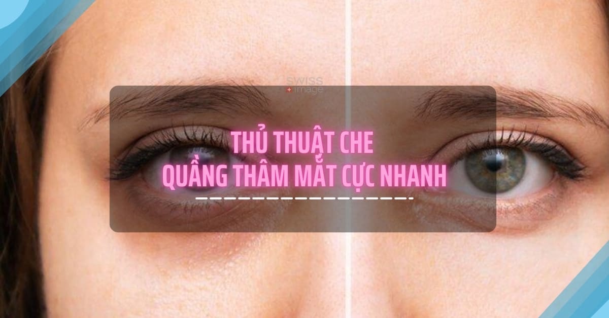 Thủ thuật che quầng thâm mắt cực nhanh